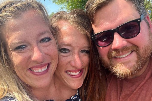 Inside conjoined twin Abby Hensel’s relationship with Josh Bowling and secret wedding
