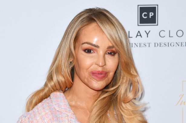 Inside Katie Piper’s inspirational recovery from devastating acid attack to ‘chaotic’ family life
